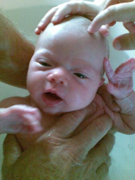 Dana McCaffery died from whooping cough.