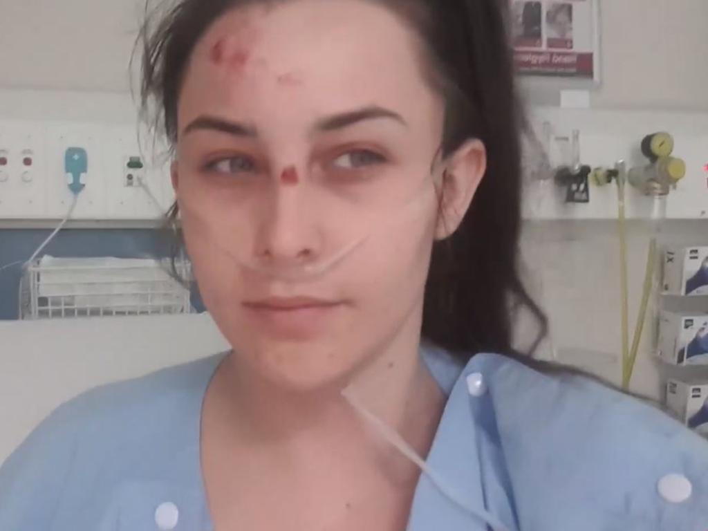 Keana Ball has shared confronting images of her injuries after she was attacked by her ex. Picture: Facebook/Keana