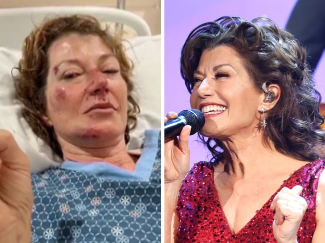 Amy Grant gets acciddental face-lift during surgery.