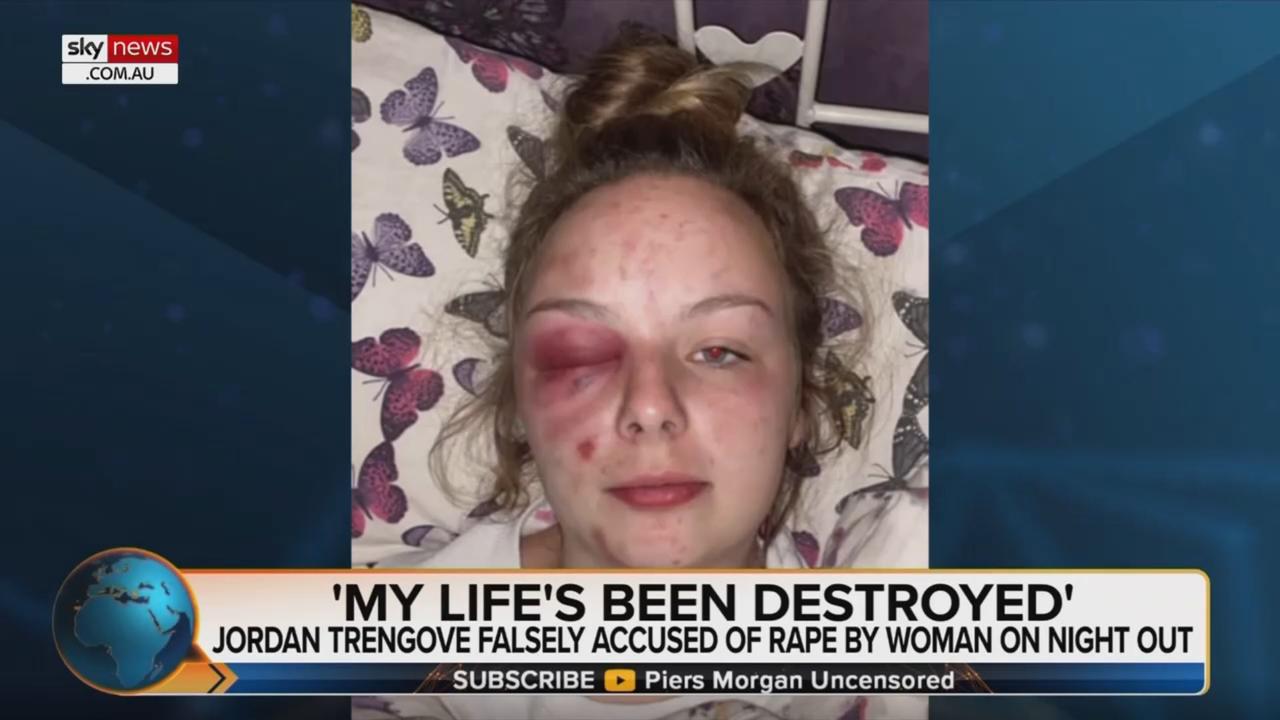 Williams inflicted her injuries on herself. Picture: Sky News Australia/Piers Morgan Uncensored