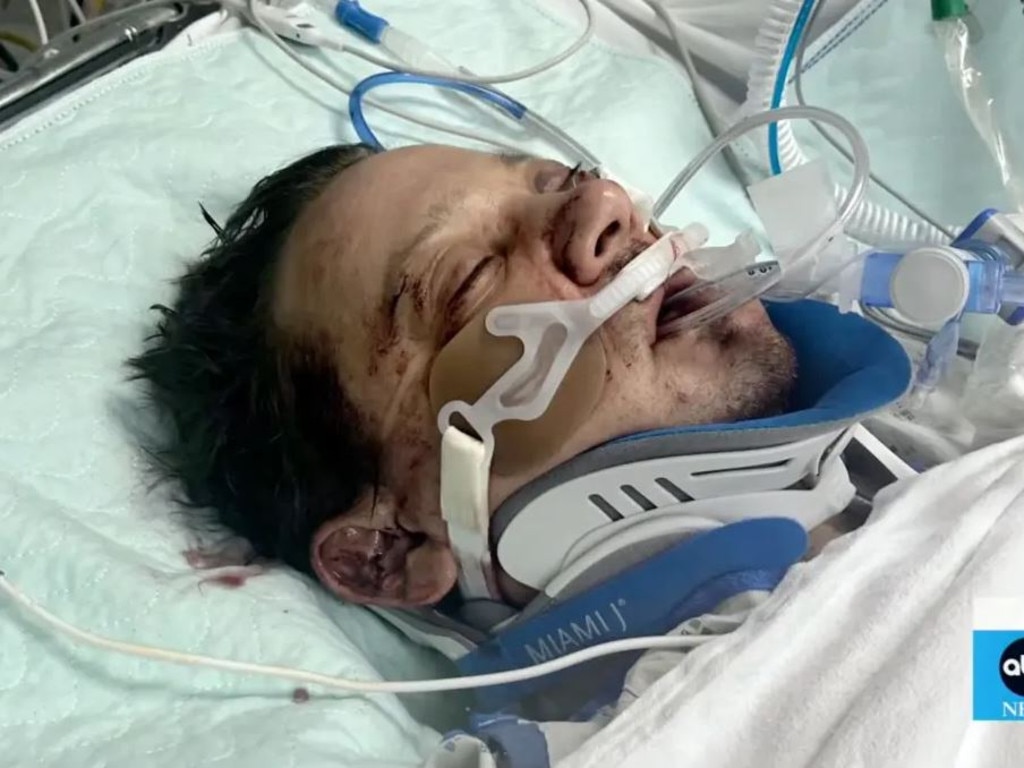 Jeremy Renner was writing his “last words” to his family while in the hospital. Picture: ABC