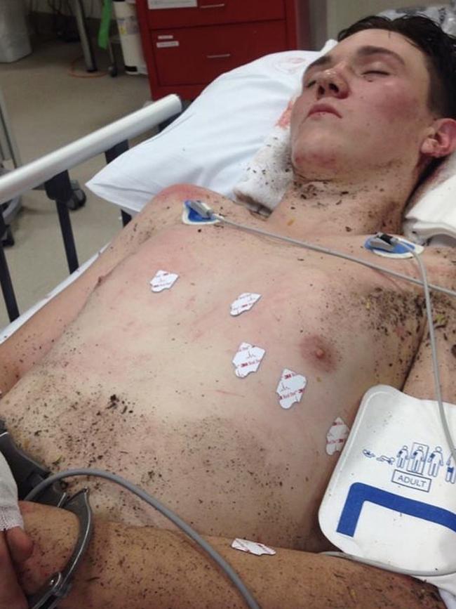 YNG Martyr in hospital after overdosing on synthetic acid 25i-NBOMe in Townsville