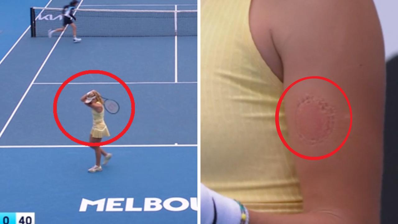 11 Embarrassing When You See It Pictures Of Female Tennis Players
