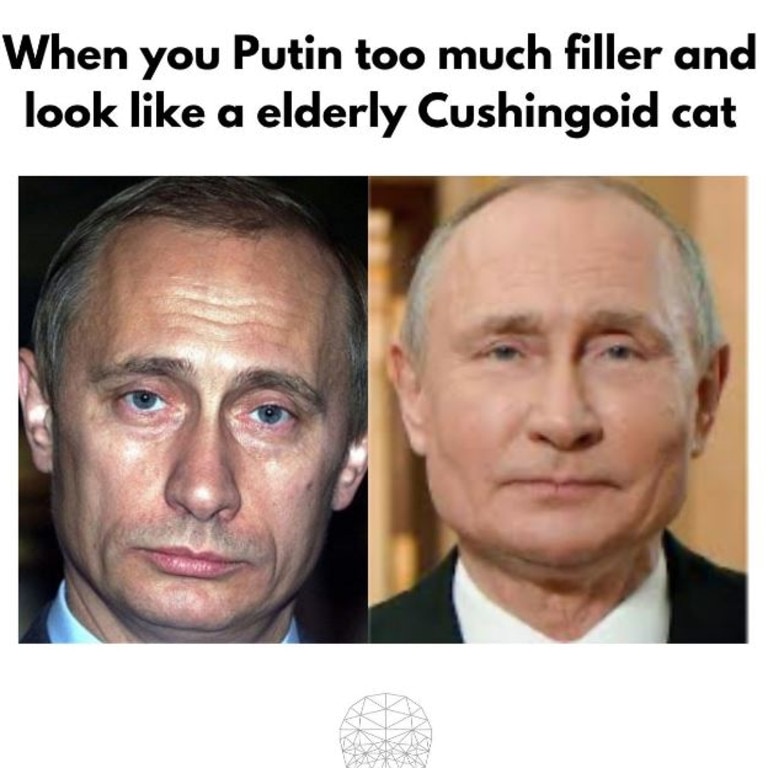 Vladimir Putin Plastic Surgery Has Russian President Had Filler Botox