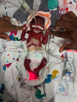 Tyler and Irve, holding hands with Eli in the NICU. Picture: Caters News