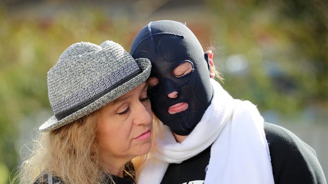 White Island volcano survivor Stephanie Browitt with her mother, Marie. Picture: Alex Coppel