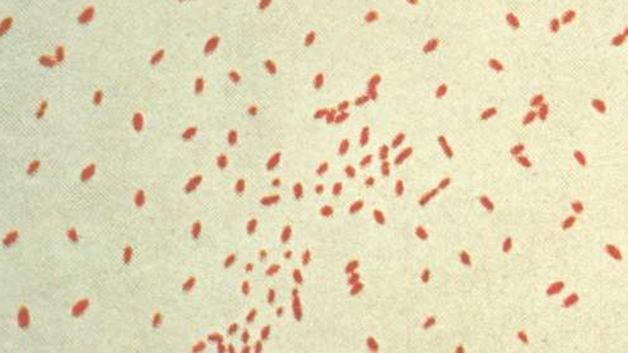 State hit by record outbreak of deadly virus