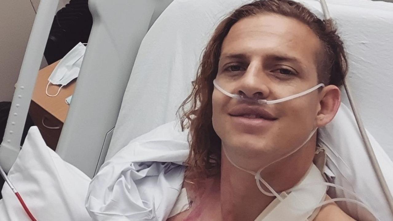 Nat Fyfe is done for the season.