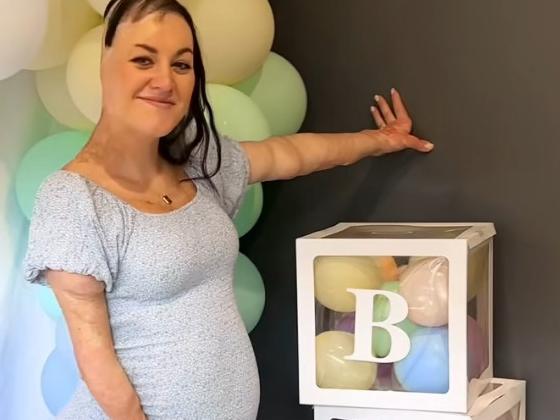 Burns survivor Sophie Delezio announced she is expecting a baby boy with fiance Joseph Salerno on July 23. Picture: Instagram