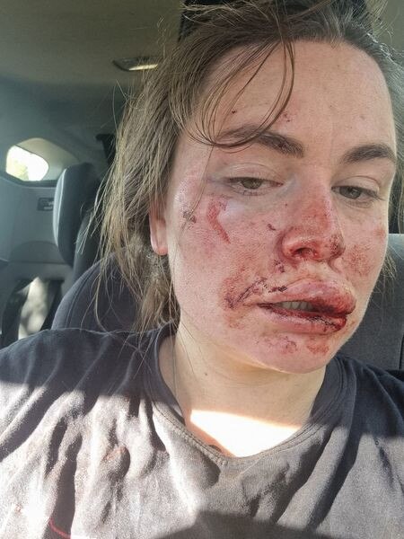 Sissy Austin, 29, was viciously attacked while running near Ballarat last year.