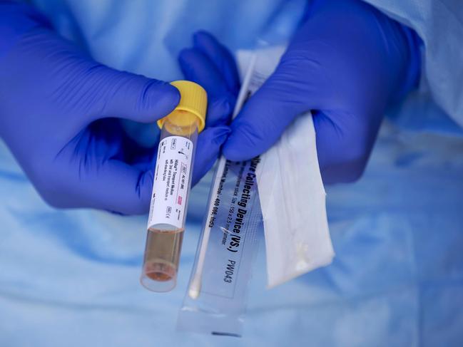 A medical staff displays a test kit to detect the novel coronavirus at a COVID-19 screening-drive, at the  Amsterdam UMC in Amsterdam The Netherlands, on March 24, 2020. (Photo by Robin VAN LONKHUIJSEN / ANP / AFP) / Netherlands OUT