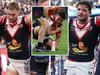 Radley to sidestep surgery in bid to return to injury-hit Roosters