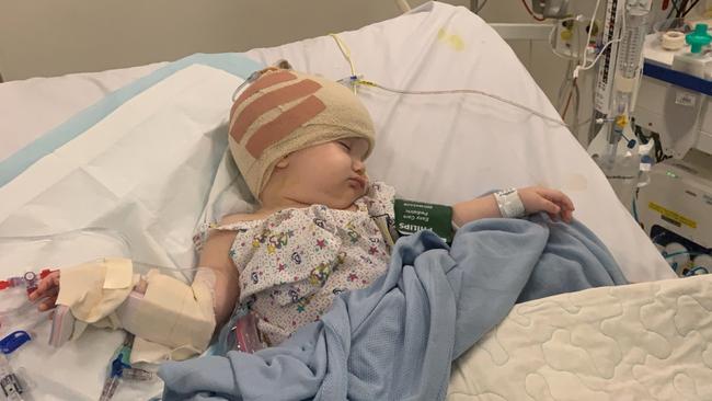 Katherine toddler Zahli Rose Brown has undergone major brain surgery after doctors discovered a large tumour in her head. Picture: Supplied.