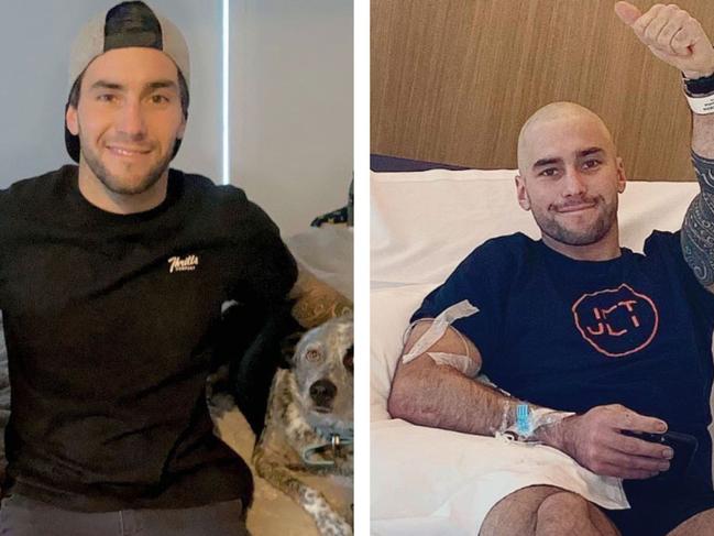 Josh Robson before and after he started chemo treatment for testicular cancer. Picture: Instagram /@robie92_onenut