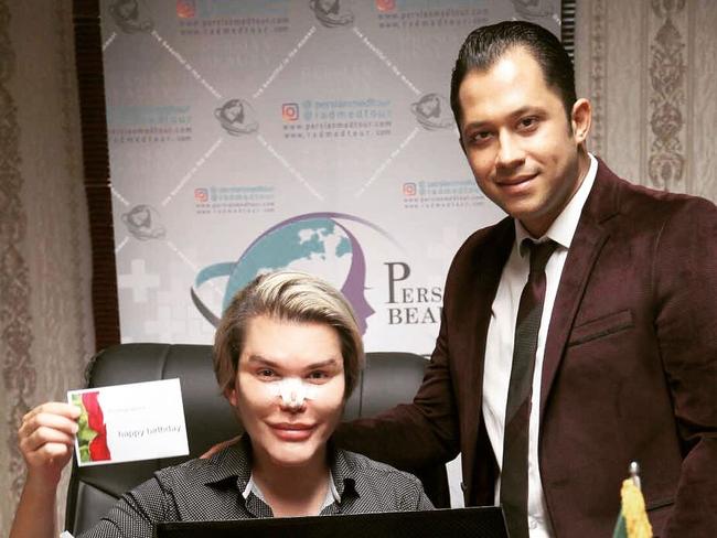 Rodrigo needed another nose job to help him breathe after a previous op left him with too-small nasal passages. Picture: Rodrigo Alves/Instagram