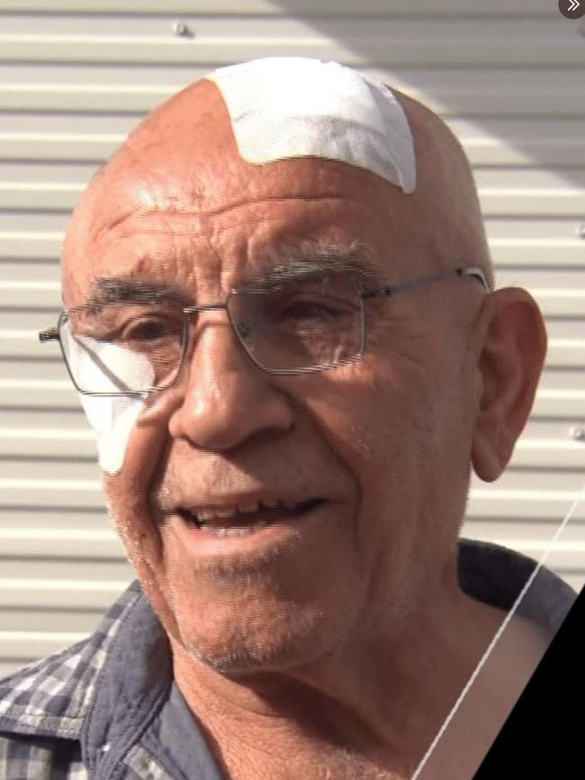 An elderly victim who was brutally bashed in the head with a gun on Port Road has spoken to 7NEWS as he left hospital. Picture: 7NEWS