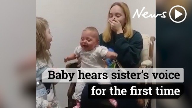 Touching moment a hearing impaired baby girl hears her sister for the first time