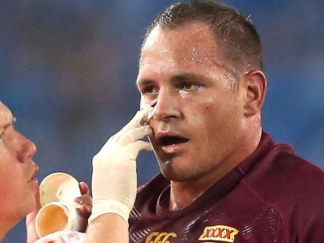 SYDNEY, AUSTRALIA - JUNE 18: Matt Scott of the Maroons receives treatment during game two of the State of Origin series between the New South Wales Blues and the Queensland Maroons at ANZ Stadium on June 18, 2014 in Sydney, Australia. (Photo by Mark Metcalfe/Getty Images)