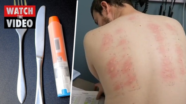 Got a weird skin rash? Maybe Facebook can help - CBS News