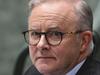Albo breaks silence over leaked text saga