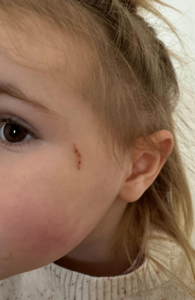 Two-year-old Effie was attacked by the magpie. Picture: 7News