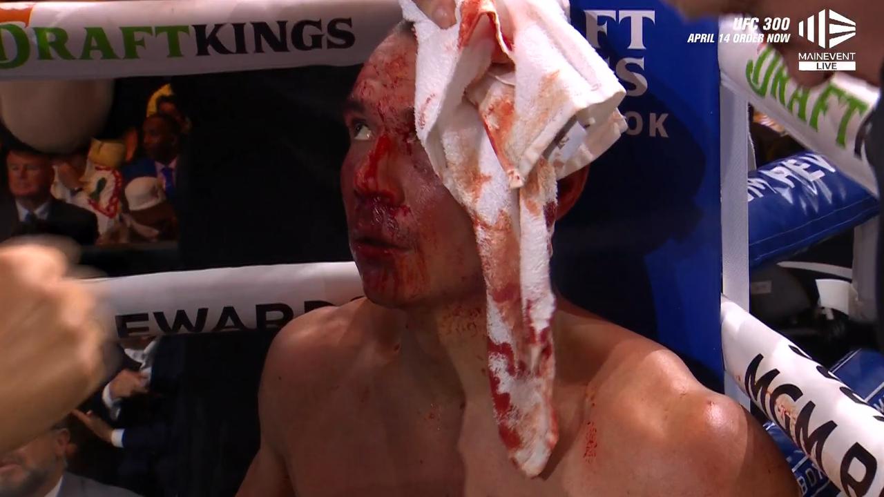 Perhaps this towel should have been thrown. Photo: Main Event.