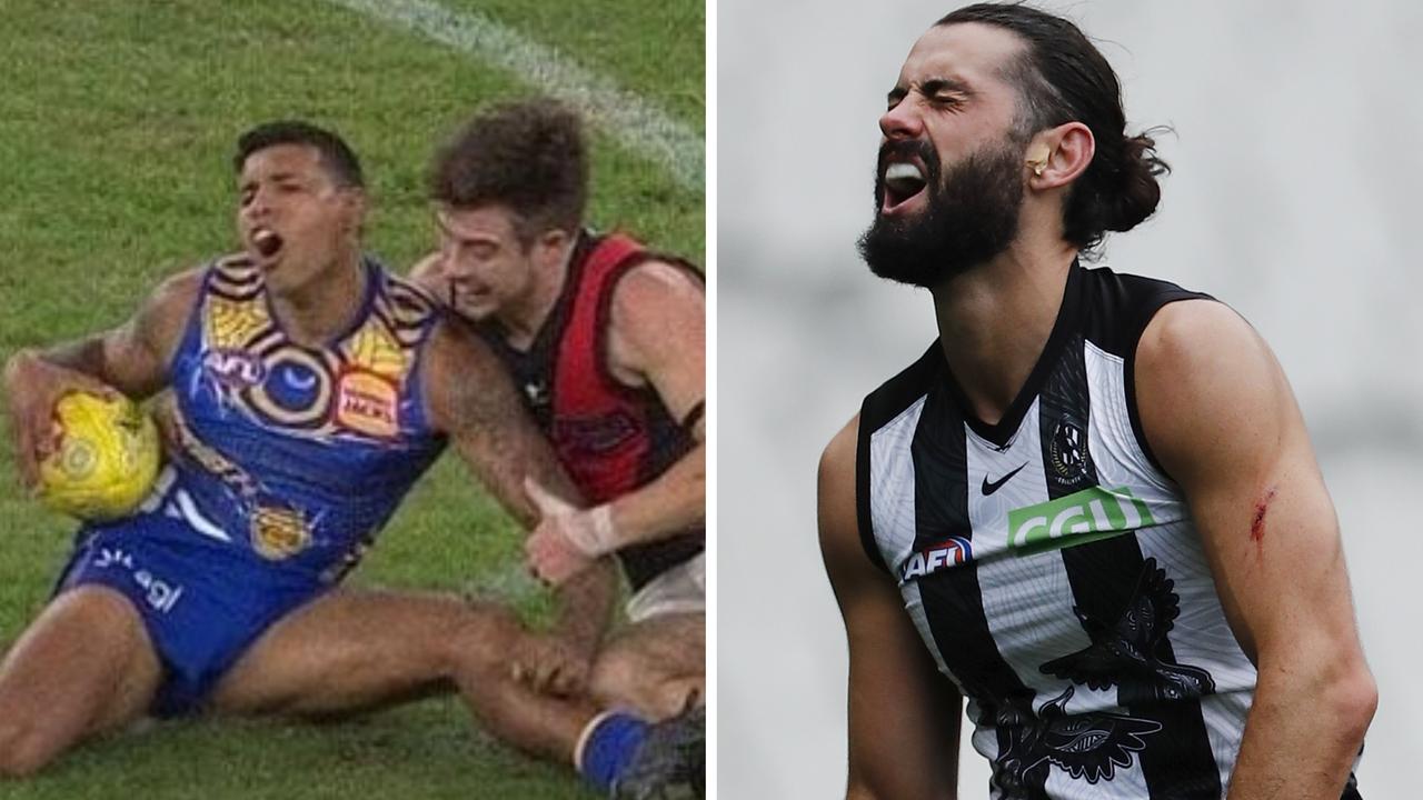 Tim Kelly and Brodie Grundy are both facing stints on the sidelines after Round 11 injuries.