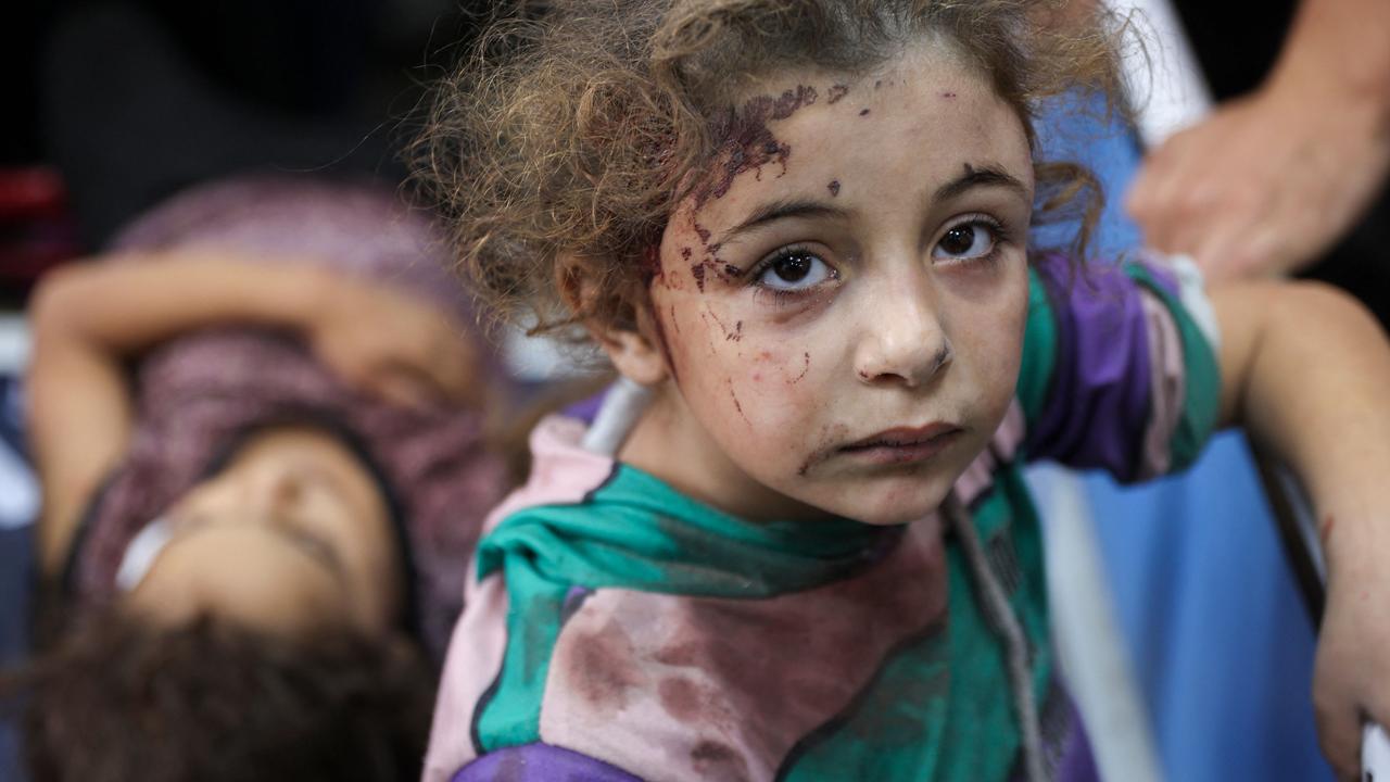 Children who were injured during an Israeli operation in the Jabalia refugee camp, awaiting treatment at a hospital. Picture: Omar al-Qattaa/AFP