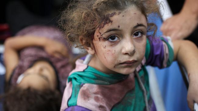 Children who were injured during an Israeli operation in the Jabalia refugee camp, awaiting treatment at a hospital. Picture: Omar al-Qattaa/AFP