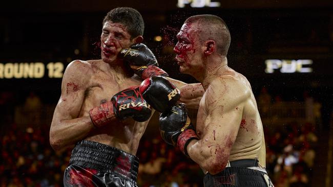 Sebastian Fundora’s nose was broken in the fight. Supplied No Limit Boxing