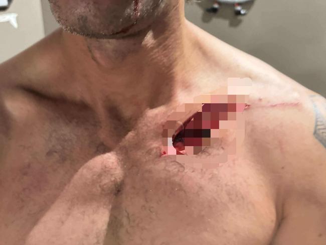 Whetu Tokotaua was allegedly sliced open during a clash on December 13. Picture: Supplied