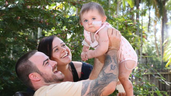 Baby Lilliana Sheridan contracted meningococcal in Thailand and almost had to have her legs amputated. Lilliana is finally at home at Nerang with parents Jai Sheridan and Elisha Robinson. Picture Glenn Hampson