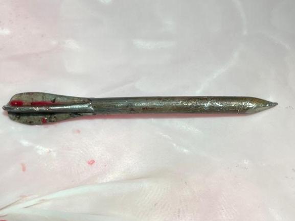 A FLECHETTE Craig Jurisevic removed from a civilian in Ukraine. Picture: Supplied