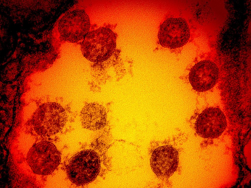 Victoria recorded 725 new cases of coronavirus (pictured) on Wednesday. Picture: AFP/NATIONAL INSTITUTE OF ALLERGY AND INFECTIOUS DISEASES