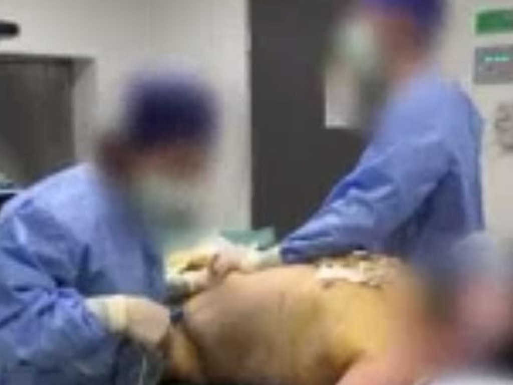 Two male surgeons who worked for Dr Lanzer seen dancing to Jolene while performing liposuction on an unconscious patient. Picture: Four Corners/ABC