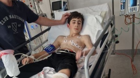 The teen has since undergone surgery in Sunshine Hospital due to serious injuries suffered in the alleged hit-and-run. Picture: Supplied