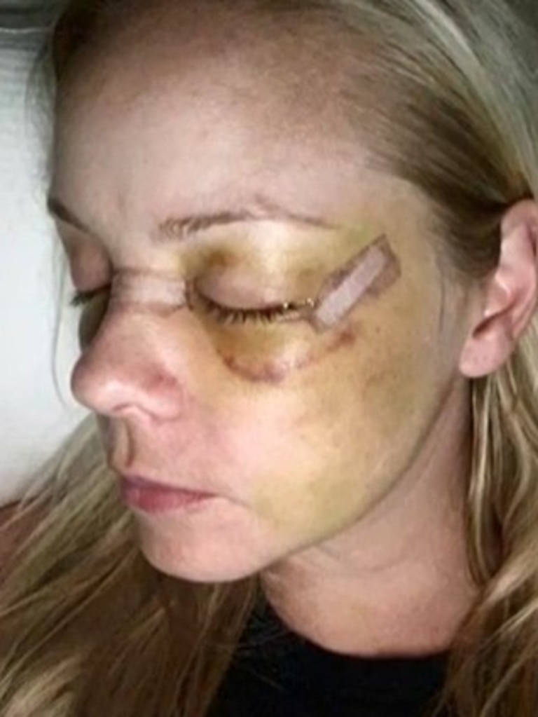 The he viciously beat her. Picture: Channel 9