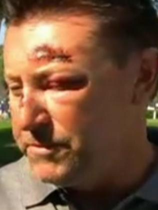 Australian golfer Robert Allenby said he was kidnapped, beaten and robbed in Honolulu last year. Picture: Supplied