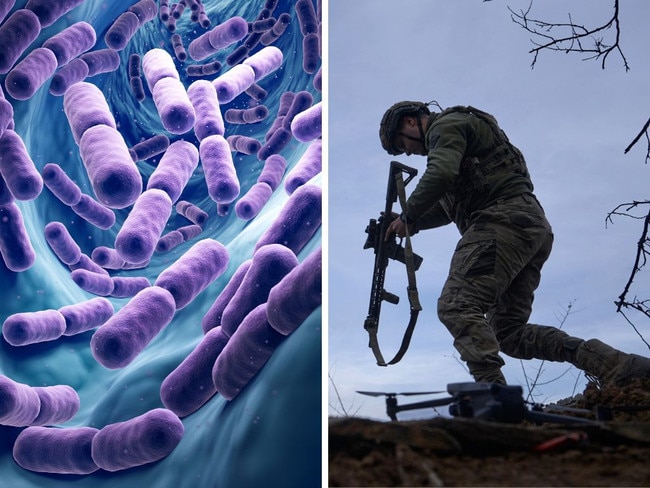 A superbug is a growing threat in warzones.