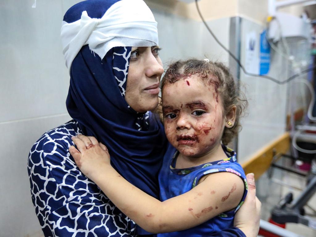 Palestinians injured in Israeli air raids arrive at Nasser Medical Hospital in Khan Yunis, Gaza. Picture: Getty Images