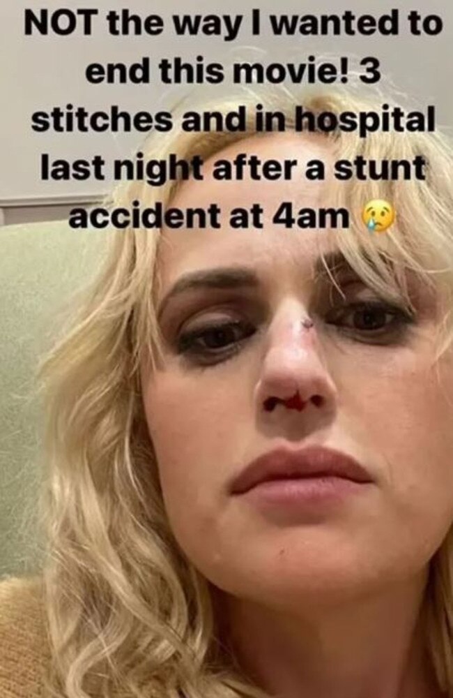 Rebel Wilson has shared on social media the results of a stunt that went wrong and landed the Aussie actress in hospital. Picture: Instagram