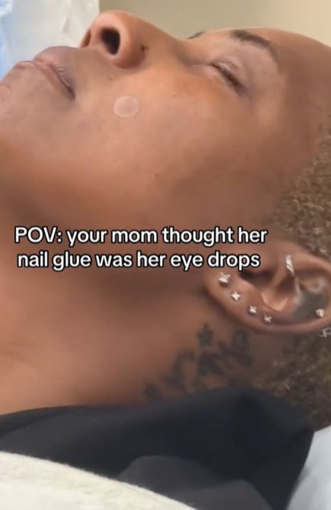 A mum mistook her nail glue for eye drops. Picture: TikTok/@realbyriri