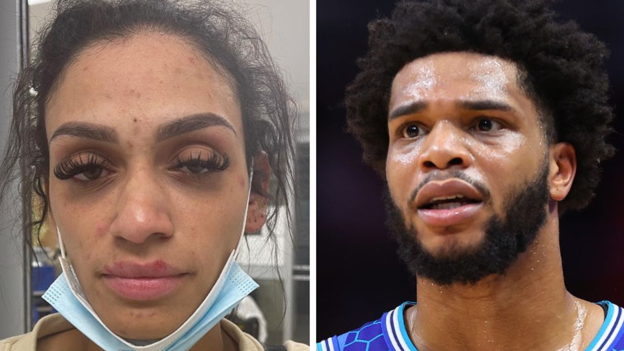 U.S. basketballer, Miles Bridges' wife posts disturbing photos of