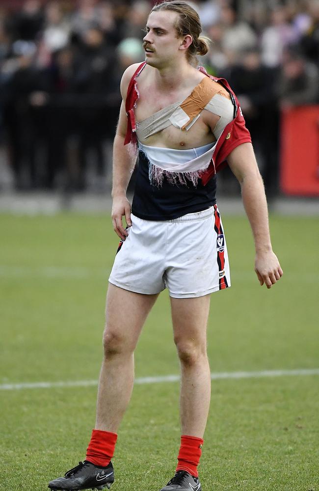 Mt Eliza’s Elliot Simmons modelling a new range of light and comfortable attire after an altercation with opposition players. Picture: Andrew Batsch