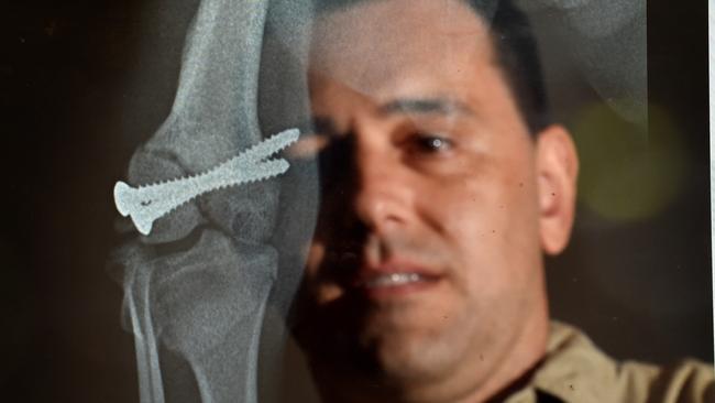 Joint replacement surgeries are rising year-on-year due to an ageing population, with public hospitals failing to meet demand and leaving health outcomes on the decline as a result. Picture: Jay Town