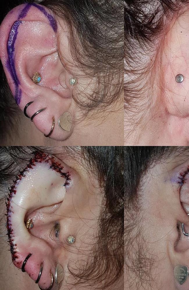 A woman gets her ears cut into pixie shapes.