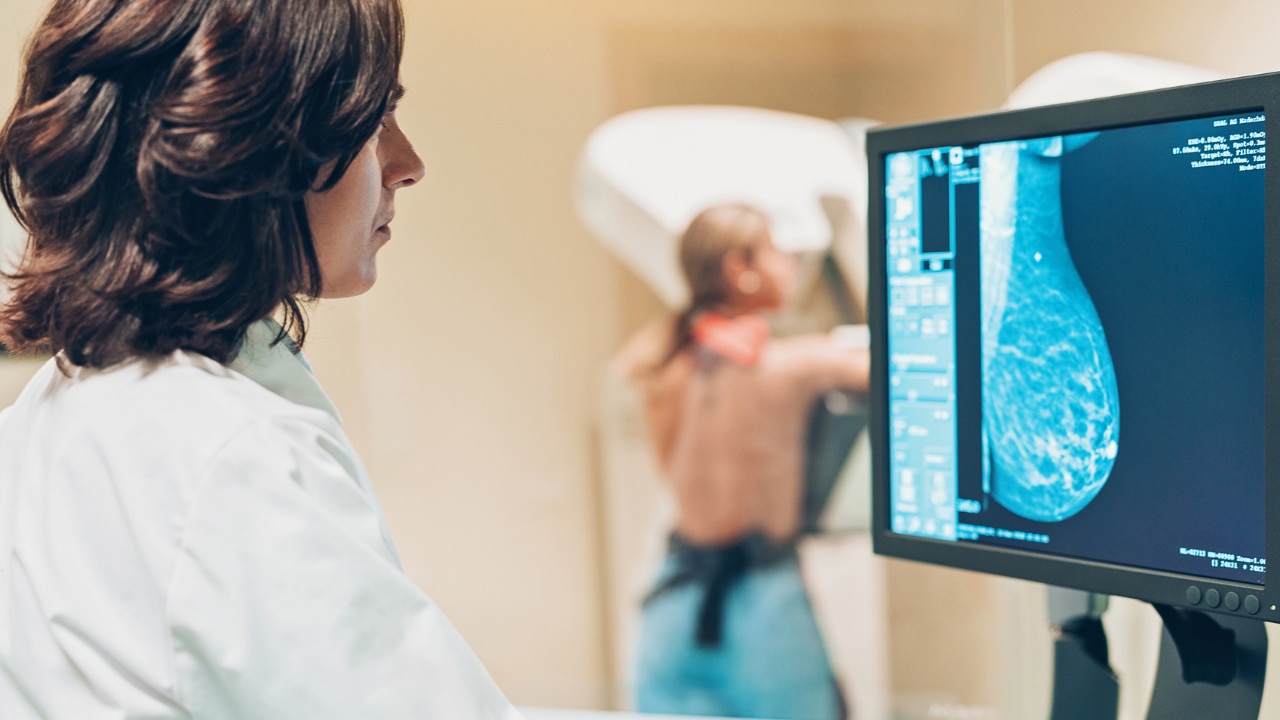 <h2>Breast density and medical imaging</h2><p><span>Dense breasts can make it harder to detect cancers in mammograms, as both cancers and density appear white in imaging. So while it can be relatively clear to see a bright white cancer spot among dark fatty tissue in an image, a cancer surrounded by dense fibrous and glandular tissue can go undetected.&nbsp;</span></p><p><span>Speaking to the </span><a href="https://www.abc.net.au/news/2025-02-11/mandatory-breast-density-reporting/104889340" target="_blank" rel="noopener"><i><span>ABC</span></i></a><i><span>,</span></i><span> radiologist Professor Mary Rickard said mammograms are highly effective to detect early cancer, but added that reports can differ based on patients&rsquo; breast density.&nbsp;</span></p><p><span>"A woman who's got low density breasts &hellip; has a very good chance that's a totally accurate report," she said.</span></p><p><span>"If she goes in with high density breasts, there is a significant risk that her cancer might be missed."</span></p>