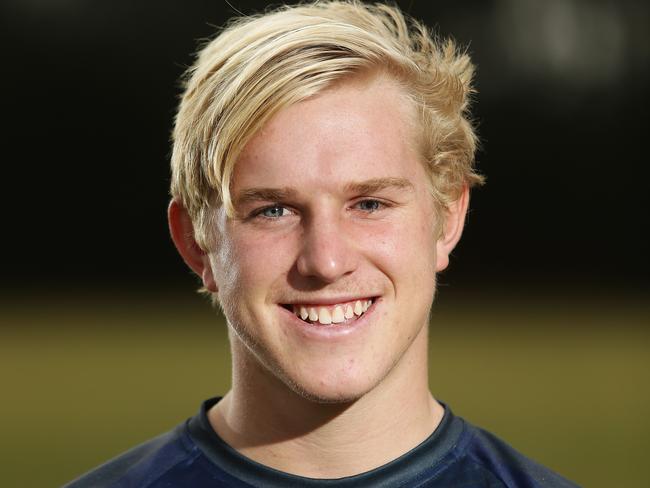 Jackson Willis had his left eye removed when he was two-years old. Pic Brett Costello