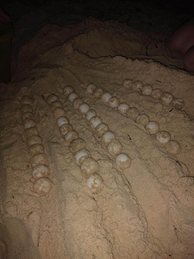 On Sunday, a Gold Coast local found a loggerhead sea turtle, which had burrowed itself within the sand dunes at Palm Beach, laid more than 40 eggs. Photo: Watergum Community