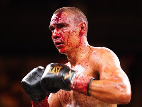 Tim Tszyu covered in blood. Photo: Twitter, No Limit Boxing.